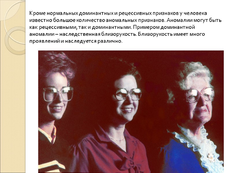 Кроме нормальных доминантных и рецессивных признаков у человека известно большое количество аномальных признаков. Аномалии